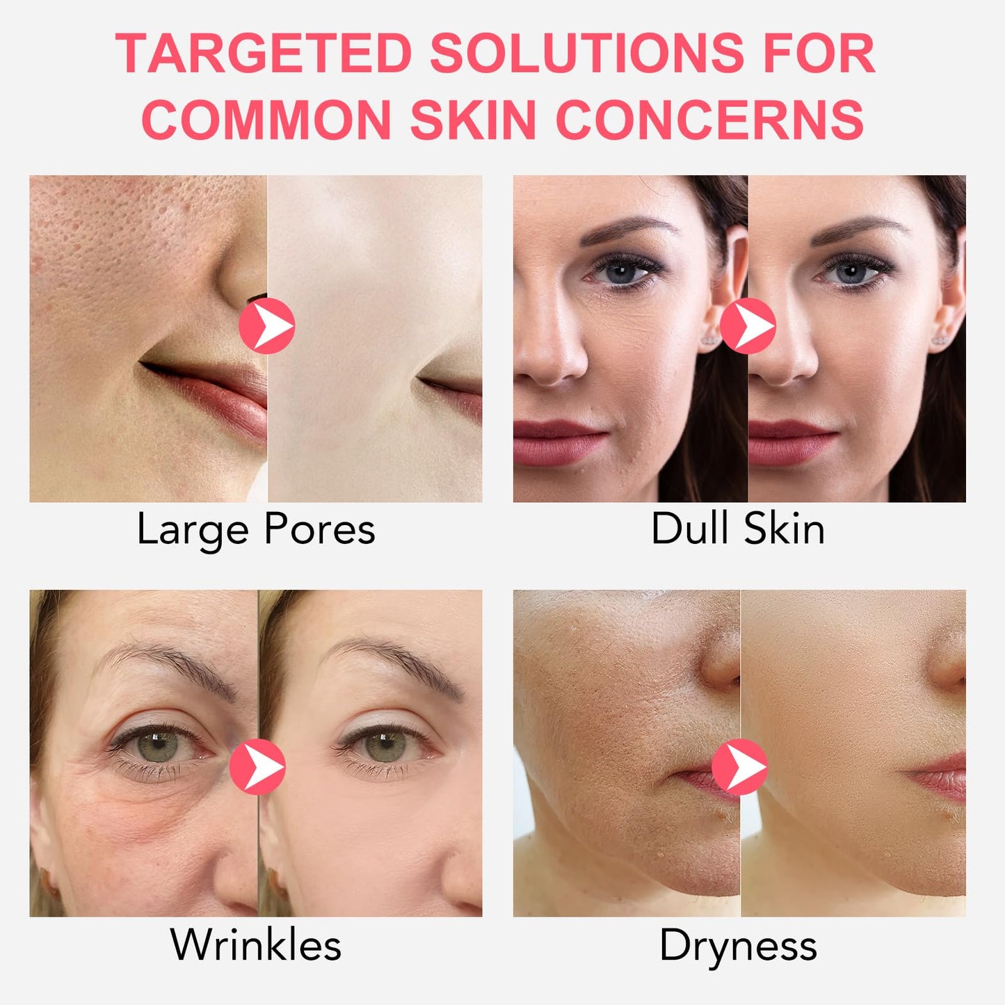 BIO COLLAGEN Máscara Facial Hidrogel 4 Peças | Hidratação Profunda Anti-Idade | Parafarmácia