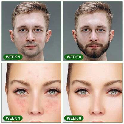 URAQT Dermaroller Microagulhas 0.5mm Titânio | Rosto e Corpo Anti-Idade | Cosmética